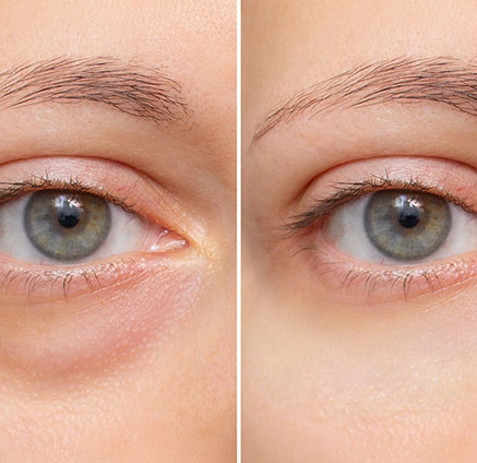 Eye Perfection