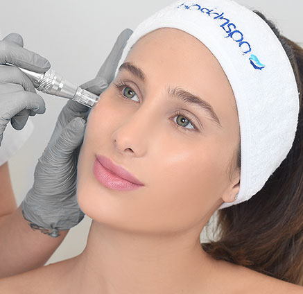MesoTherapy