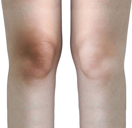 Miracle Body Whitening 